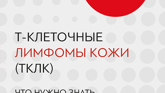 Т-клеточные лимфомы кожи (ТКЛК): что нужно знать об этом диагнозе?