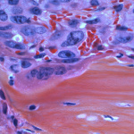 Related article thumbnail