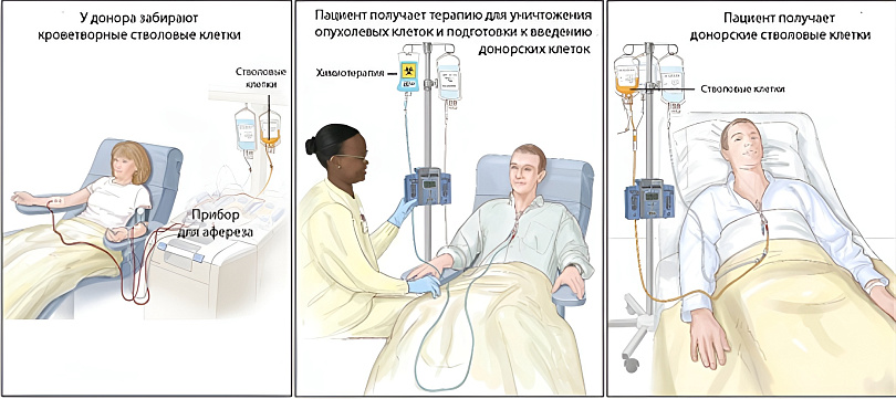 Процесс ТКМ