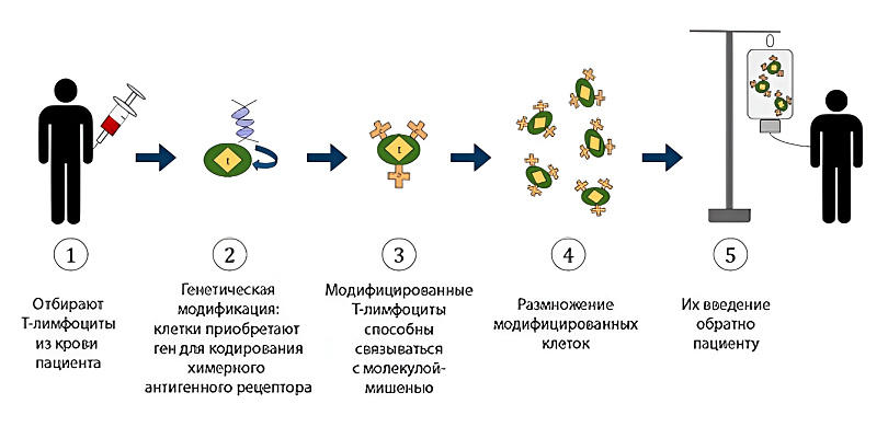 CAR-T-клеточная терапия